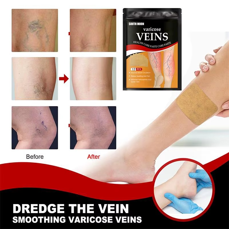 Varicose Veins - 36 Parches para el alivio de várices