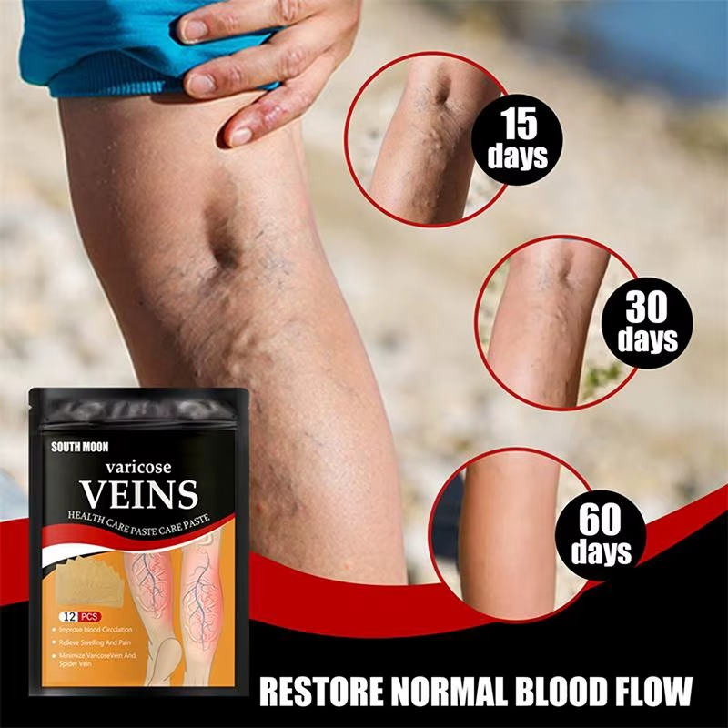 Varicose Veins - 36 Parches para el alivio de várices